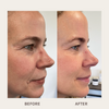 Age Defying Lifting Serum