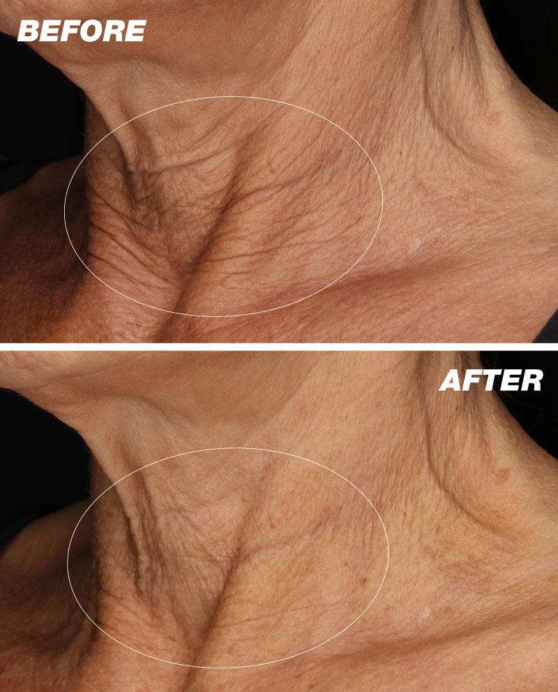 Neck Contour Serum