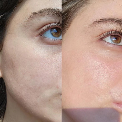Eco by Sonya - Serum Of Clear (Serum de rosto)